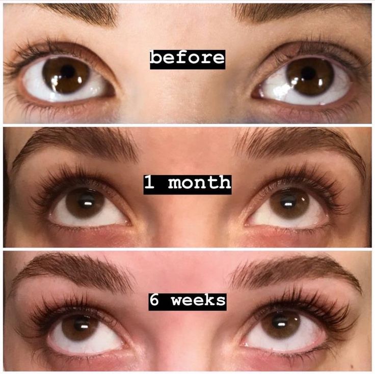Wimpernserum für längere und dichtere Wimpern -    Zorenza